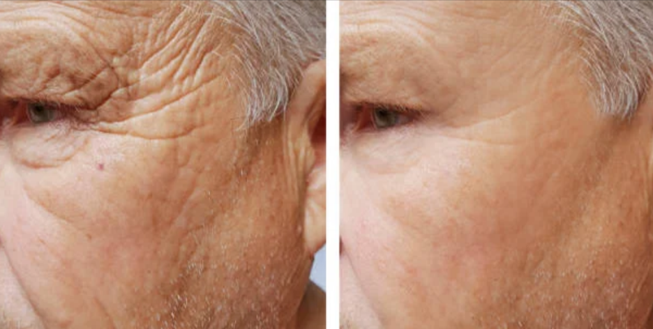 VYNE Anti-Aging Serum Benefits